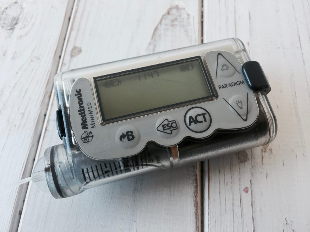 инсулиновая помпа: минусы и плюсы